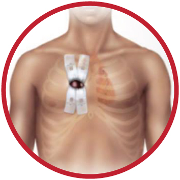 cirurgia minimamente invasiva