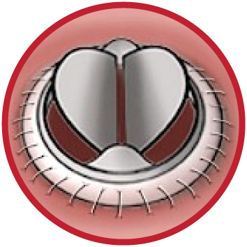 cirurgia valvar